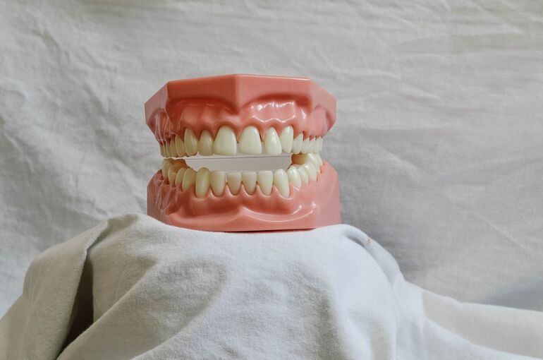 veronicatxoxo-teeth-5522650_1920